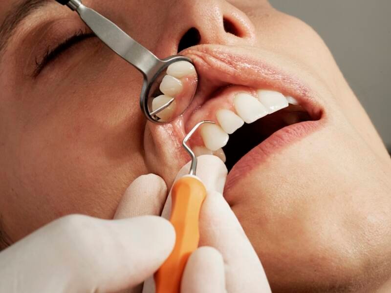 Home Close-up of a bright, white smile after teeth whitening